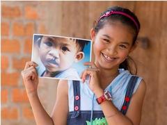 Hotels support Operation Smile Vietnam