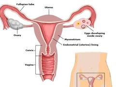 To-your-health: Understanding Hysterectomy