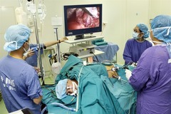 Experts share international experience on organ transplant