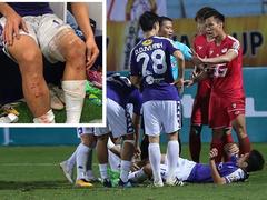 National team captain banned by own club for dangerous tackle