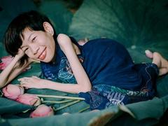 Photographer showcases beauty of the disabled